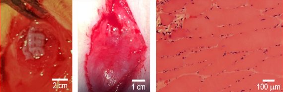 왼쪽 사진은 쥐의 측두근 이식 직후 조직 부위의 모습을 보여주며, 중앙의 이식 8주 후 개발된 근육 조직을 이식해 손상 부위가 완벽히 재생 된 모습을 보여주고 있다. 우측의 면역화학적 조직염색 결과 또한 근육 조직 이식 후 8주 후에 완벽히 재생해 섬유화가 거의 없는 모습을 보여준다. 연구재단 제공