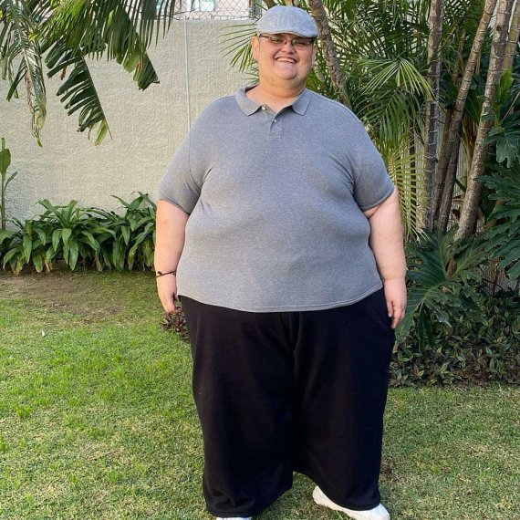 세계에서 가장 뚱뚱한 男, 330kg 감량.. "혼자 걸을 수 있어요"