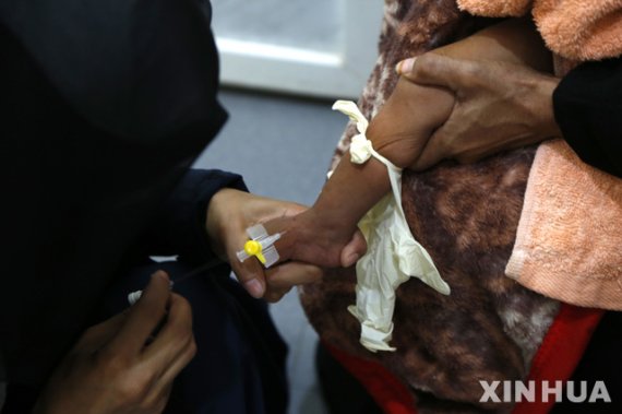 [사나(예멘)=신화/뉴시스]26일(현지시간) 예멘 수도 사나의 알사빈 병원 영양실조 예방 병동에서 영양실조에 걸린 한 아이가 치료받고 있다. 스테판 두자릭 유엔 대변인은 예멘 인구의 80%인 2400만 명 이상이 어떤 형태로든 인도적 지원이 필요하며 약 740만 명엔 영양지원이, 그중 320만 명에는 급성 영양실조에 대한 치료가 필요하다고 밝혔다. 2019.12.27.