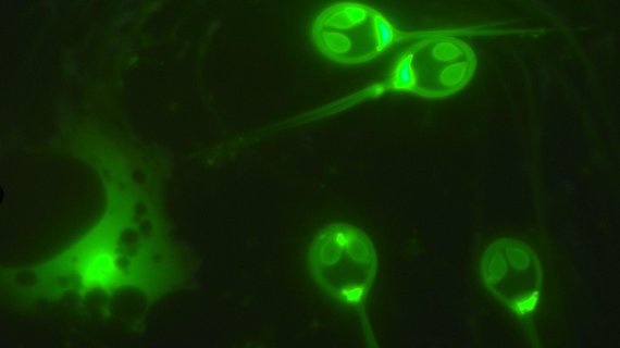 산소를 호흡하지 않는 작은 기생충 '헤네구야 살미니콜라(Henneguya salminicola)'. 스티븐 앳킨슨 제공