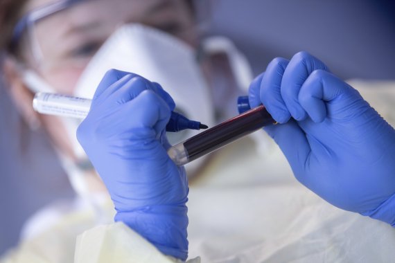 지난 19일(현지시간) 독일 로버트 코호 연구소의 직원이 항체 실험을 위해 채혈된 혈액이 담긴 실험관 라벨에 표기를 하고 있다.AP뉴시스