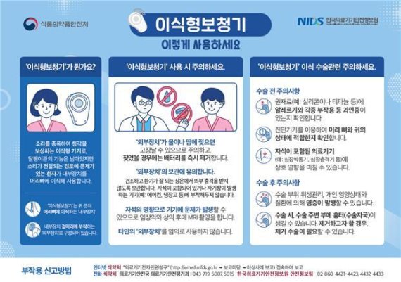 이식형보청기의 올바른 사용법(식품의약품안전처 제공)© 뉴스1