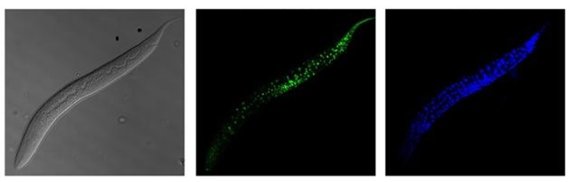 예쁜꼬마선충에서 초록색 형광으로 표지된 VRK1 단백질(가운데). 파란색 형광은 세포의 핵을 표지(오른쪽)한 것으로 VRK1 단백질은 예쁜 꼬마 선충의 다양한 조직에서 나타난다. 한국과학기술원 이승재 교수 제공
