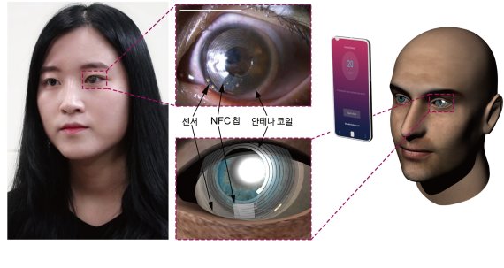 박장웅 박사 연구팀이 개발한 스마트 렌즈는 실제 소프트 콘택트렌즈 사용 물질로 제작돼 이물감이 적으며 안전하다. 렌즈 안에 센서와 NFC칩, 안테나 코일이 들어가 있어 스마트 렌즈를 착용한 후 스마트폰을 눈 주위로 가져가 태그하면 정확한 스트레스 호르몬 수치를 실시간으로 확인할 수 있다. IBS 제공