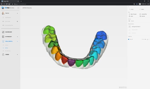 이마고웍스 디지털 치과 솔루션 화면. 인공지능(딥러닝) 기술이 환자의 3차원 치아 스캔 데이터를 입력 받으면 자동으로 개별 치아 데이터를 분리한다. 기존처럼 치기공사가 수작업으로 개별 치아 데이터를 입력할 필요가 없다. 이마고웍스 제공