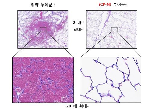 셀리버리 "무증상자 포함 코로나19 확진자, 면역치료제 반드시 투여해야"