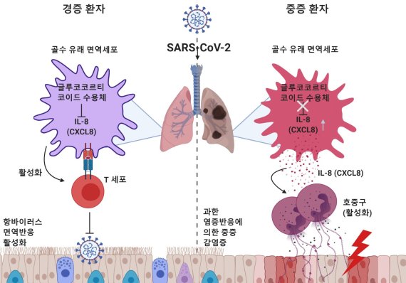 경증 환자들은 코로나19 바이러스 감염으로 정상적 T세포 매개의 면역반응이 일어난다. 글루코코르티코이드 수용체가 많이 만들어져 CXCL8의 발현이 억제돼 호중구 유입이 조절받고 있다. 반면, 글루코코르티코이드 수용체가 적게 만들어지는 중증 환자들은 CXCL8가 많이 생겨 호중구의 유입이 증가한다. 호중구의 과도한 염증성 반응에 의해 폐 조직 상피세포들이 손상을 입고 심한 호흡기 증상을 보이게 된다. 한국과학기술원 제공