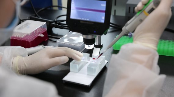 울산과학기술원 연구진이 개발한 '미세 유체 칩'에 혈액을 떨어뜨려 병원균 감염 여부를 확인하고 있다. 울산과학기술원 제공