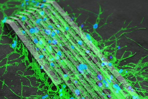 마이크로로봇에 올려진 신경세포가 마이크로 패턴을 따라 배양되는 모습을 형광이미징으로 나타내고 있다. DGIST 제공