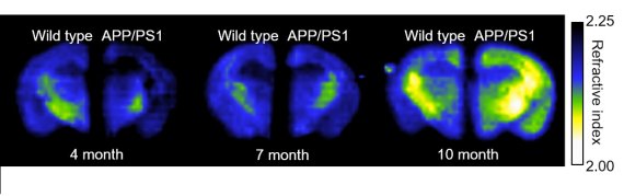 메타물질을 이용한 정상(wildtype, 왼쪽)과 치매모델(APP/PS1, 오른쪽) 쥐 뇌의 비표지 테라헤르츠 이미지. 정상보다 치매 모델 쥐 뇌에서 시간이 경과함에 따라 아밀로이드 플라크 양이 증가한다는 것을 확인할 수 있다. KIST 제공