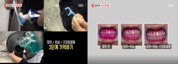 “입 속 유해균, 방치시 전신질환 발병 우려돼…구강청결제 관리 습관 필요”