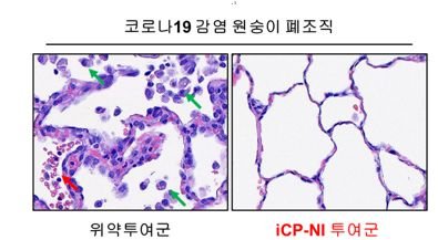 코로나19 감염 원숭이의 폐 조직파괴 치료효능. 사진=셀리버리