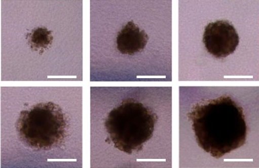 세포 스페로이드를 정밀하게 프린팅하는 '3D 바이오 도트(dot) 프린팅' 기술을 개발한 UNIST 바이오메디컬 공학과 강현욱 교수팀이 세포 농도 및 잉크의 토출 시간 조절을 통해 사이즈가 조절해 세포 스페로이드를 만들었다. UNIST 제공
