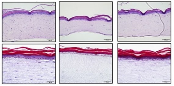 KAIST 조광현 교수팀이 노화된 인간 진피섬유아세포로 만들어진 3D 인공피부 모델에 PDK1 단백질 저해제 'BX795'를 첨가하자 정상적인 젊은 피부의 형태와 기능을 회복했다. 사진 왼쪽은 젊은 피부, 가운데는 인공 노화피부, 오른쪽은 PDK1 단백질 저해제 'BX795'를 첨가한 인공 노화피부. KAIST 제공