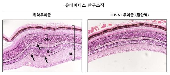 안구 자가면역질환 유베이티스 모델에서 염증으로 두꺼워지고 딱딱해져 변형된 망막층 및 붕괴된 내외 과립층 안구구조(왼쪽)를 'iCP-NI'가 회복시키고 있다. 사진=셀리버리