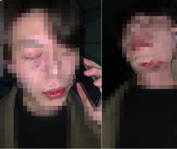 피해자 가족 측이 제공한 춘천 무차별 폭행사건 피해사진. 뉴스1 제공