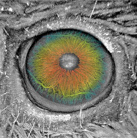 POSTECH-경북대 공동연구진이 개발한 4중 융합 영상 시스템으로 광음향과 광간섭으로 동시에 촬영한 쥐 눈 영상. 광음향은 쥐 눈의 혈관을 나타내고, 광간섭은 쥐 눈의 구조를 나타낸다. POSTECH 제공