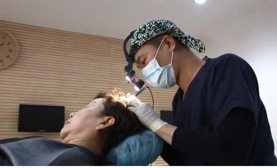 [건강고민 뚝딱]봄바람 불면 탈모여성 속앓이..."모낭부터 확인"