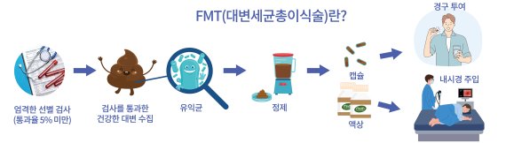 마이크로바이오틱스-체크엔케어, 대변이식술 확산 협력