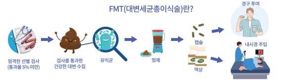 [서울=뉴시스] 건강한 사람의 대변 미생물 군집(총)을 환자의 장에 이식해 치료하는 '대변 미생물총 이식(FMT)'. (자료= 세브란스병원 제공) 2021.03.30