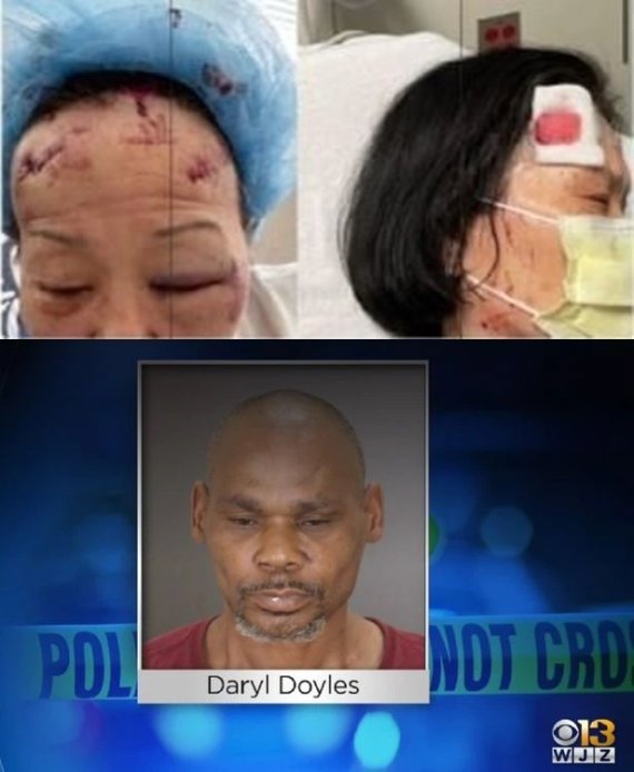 한인 자매(위)를 공격한 남성(아래). (미 볼티모어 지역방송 WJZ 갈무리) © 뉴스1