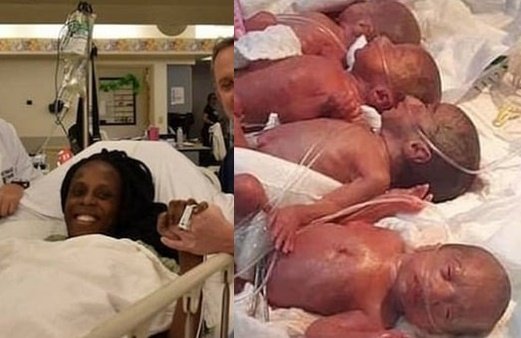 아홉쌍둥이 출산한 25세 여성 "7명 예상했는데…"