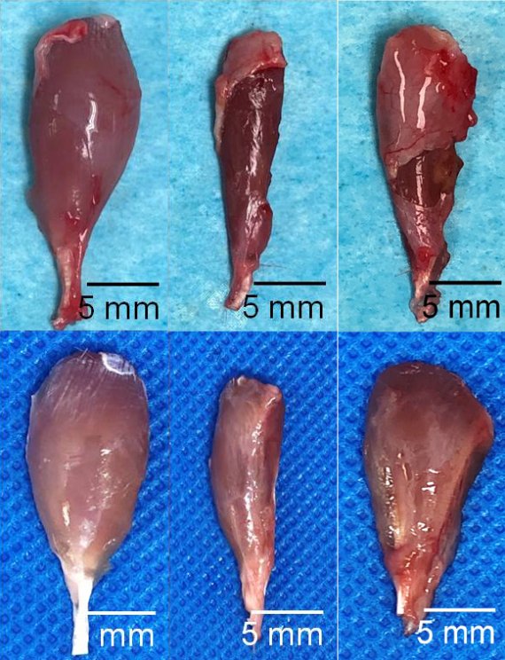 연구진이 개발한 바이오잉크를 이용해 인공근육원섬유를 만들어 실험쥐의 뒷다리 근육에 이식한 결과 근육이 재생됐다. 위줄 사진은 실험쥐의 뒷다리 근육 일부분이 잘려져 나간뒤 4주, 8주가 지난뒤의 근육형태. 아랫줄 사진은 실험쥐의 뒷다리 근육에 인공근육 원섬유를 이식한 뒤 4주, 8주가 지난 뒤의 근육형태. 성균관대 김근형 교수 제공