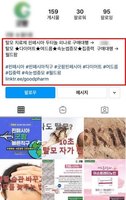 SNS 판매 탈모치료제 불법 '핀페시아' 부작용 위험높아