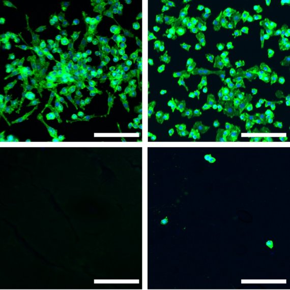 KIST 조일주 단장팀이 실험쥐의 뇌에 단분자막과 윤활유로 코팅한 백금흑(왼쪽 아래)과 실리콘산화물(오른쪽 아래)을 삽입해도 면역세포들이 달라붙지 않았다. 코팅하지 않은 백금흑(왼쪽 위)과 실리콘산화물(오른쪽 위)에는 면역세포들이 붙어 있다. KIST 제공