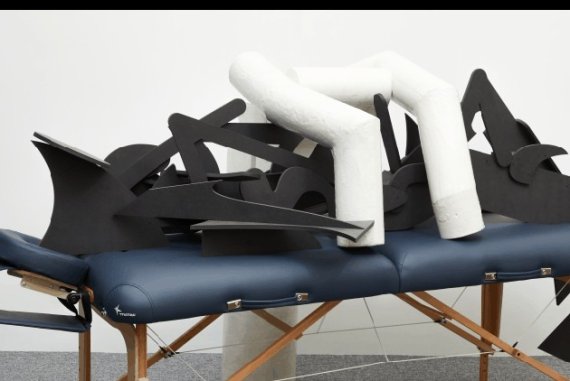 최하늘 작 도수치료© 뉴스1