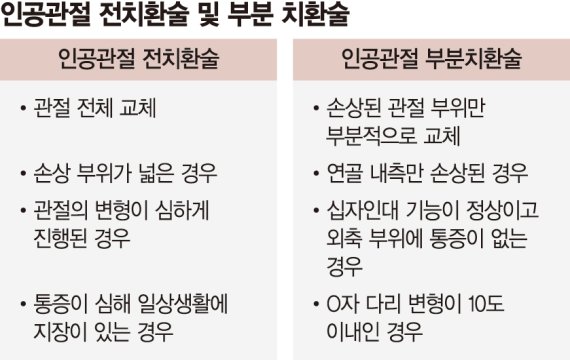 손상부위만 교체… 내 관절 최대한 살려주는 '인공관절 부분치환술' [주목해야 할 신의료 기술]