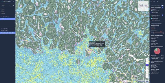 루닛, 면역항암제 반응 예측으로 맞춤형 치료 가능