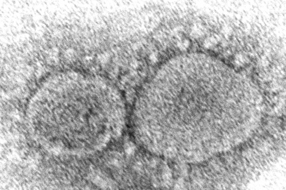 미국 질병통제예방센터(CDC)가 제공한 코로나19 바이러스 입자의 전자 현미경 이미지. AP뉴시스