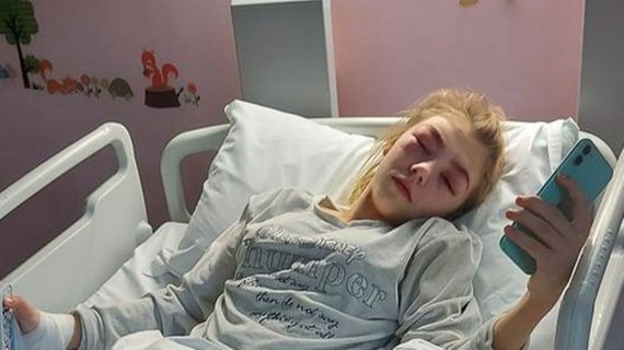 눈썹 문신과 속눈썹 연장 시술 부작용으로 시력을 잃은 뻔 한 영국의 10대 소녀가 병원에 누워있다.<div id='ad_body3' class='mbad_bottom' ></div> /사진=더미러