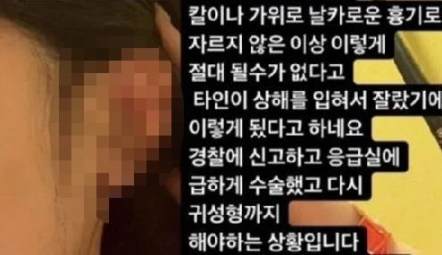 강남 클럽서 '귀 절단' 엽기 사건…女 "술 깨보니 잘려 있었다"