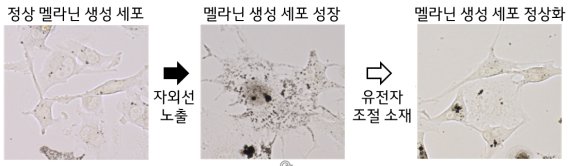 LG생활건강 "한국인의 피부 색소 침착에 관여하는 유전자 발견"