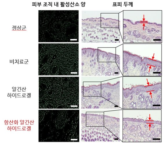 성균관대 김재윤 교수팀이 만든 항산화 하이드로겔 패치를 실험쥐에 적용한 결과 피부 조직내 활성산소 양이 감소했으며, 표피층의 두께가 눈에 띄게 얇아졌다. 성균관대 제공