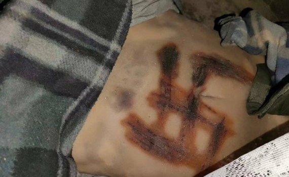 바실렌코 의원이 공개한 사진으로 우크라이나에서 발견된 숨진 여성의 몸에 나치 문양이 새겨져있다. (트위터 갈무리) /사진=뉴스1