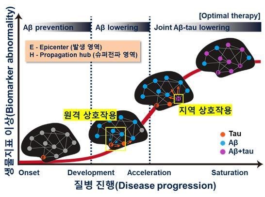 알츠하이머 진행과정에서 결정적인 두 가지 시기. (고려대 제공) © 뉴스1