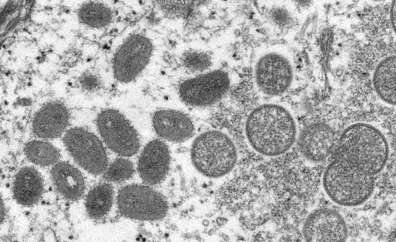 미국 질병통제예방센터(CDC)가 공개한 원숭이 두창 바이러스. /사진-로이터뉴스1