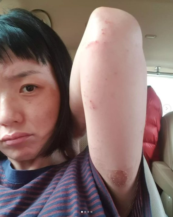 "Sofrendo de imunidade fraca"... Ahn Young Mi, 40, está preocupada com sua saúde