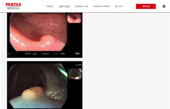 펜탁스 메디칼, 연성소화기내시경 ‘IMAGINA’ 홈페이지 리뉴얼 오픈