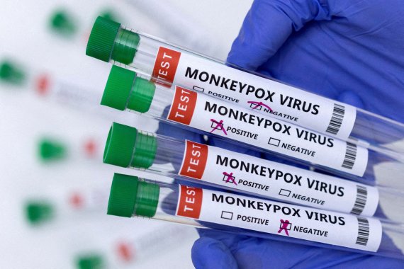 원숭이두창 감염 검사 키트. © 로이터=뉴스1 © News1 원태성 기자