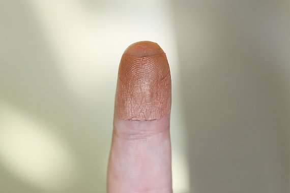 한일공동연구진이 개발한 항균 나노메쉬 패치는 매우 얇아 피부에 밀착할 수 있어 손가락의 감각을 떨어뜨리지 않는다. 생명공학연구원 제공
