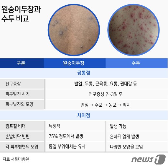 [Q&A]질병청, "원숭이두창 대유행 가능성 없다"