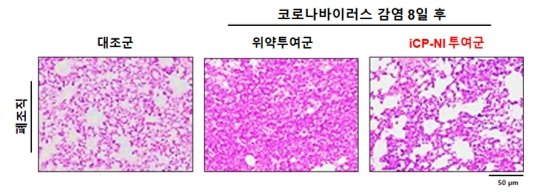 코로나 바이러스(SARS-CoV-2) 감염 실험동물의 손상된 폐 구조가 iCP-NI 투여군에서는 정상 수준으로 회복됐다. 사진=셀리버리