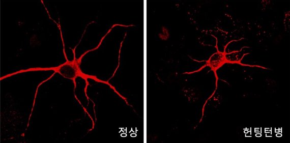 헌팅턴병 환자의 뇌조직 내 신경세포에는 돌기형성이 정상인보다 줄어들었다. KIST 제공