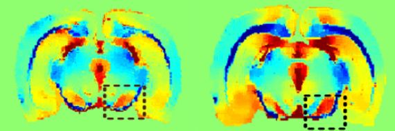 울산과학기술원(UNIST) 바이오메디컬공학과 권태준·조형준 교수팀이 늙은 쥐(오른쪽)와 어린 쥐의 중뇌에서 운동신경을 담당하는 뇌조직 '흑질' 부분을 자기공명기술(MRI)로 촬영한 결과 나이가 많을수록 흑질에 철이 더 많이 쌓여 있었다. UNIST 제공