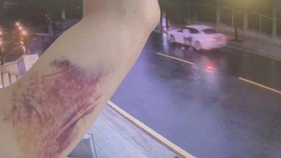 당시 운전자 이모씨(20대)는 차량 창문에 한 남성을 매단 상태로 빠르게 도로를 달렸다. 자세히 보니 남성의 한쪽 팔이 창문 틈에 끼어 있었다. JTBC 방송 캡처