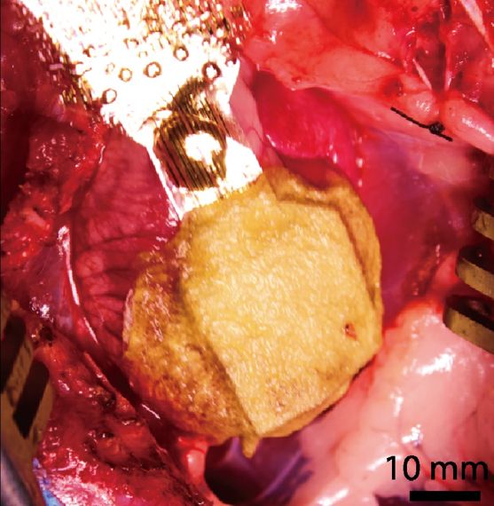 기초과학연구원(IBS) 박장웅 박사팀이 개발한 심장 부착형 전자패치를 부정맥 실험용 토끼의 심장에 붙이고 있다. IBS 제공